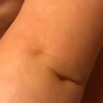 skin after picture showing results of using goat milk products