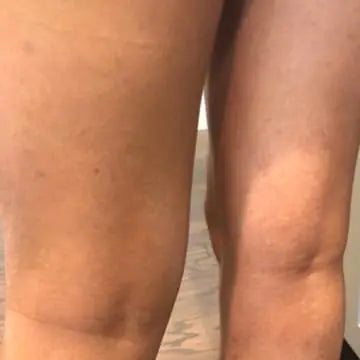 leg skin clear from eczema after using bend soap products