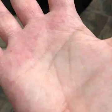 hand after using bend soap, showing clear hydrated skin