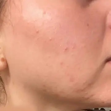 face skin with texture 